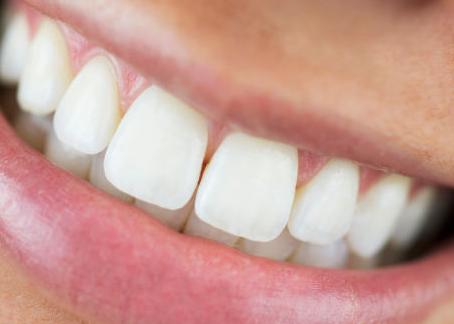 Men răng được bảo tồn tối đa khi sử dụng máy siêu âm để lấy cao răng