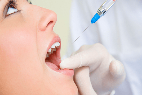 Bạn sẽ được tiêm thuốc tê trong quá trình điều trị tủy răng