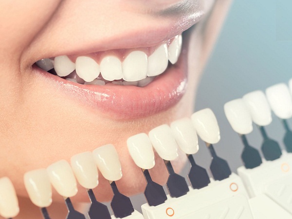 Nên chọn dòng răng sứ có tính thẩm mỹ cao, độ bền tốt để phục hình