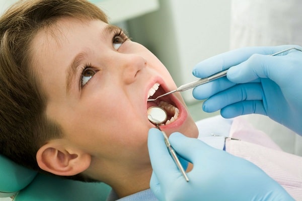  Kỹ thuật trám răng phòng ngừa giúp điều trị răng sâu cho trẻ
