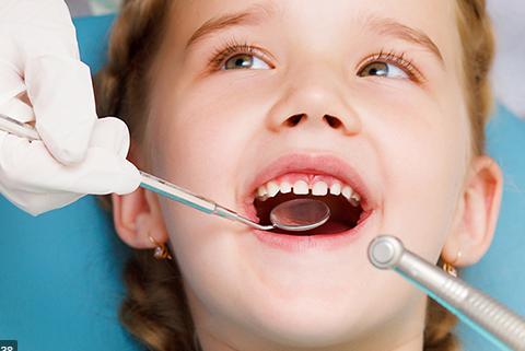 Răng sâu là tình trạng khá phổ biến ở nhiều trẻ em hiện nay