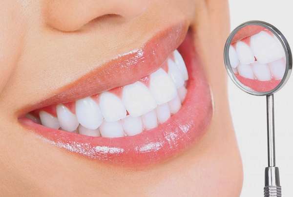 Bọc răng sứ là giải pháp khắc phục răng thưa được nhiều người ưa chuộng