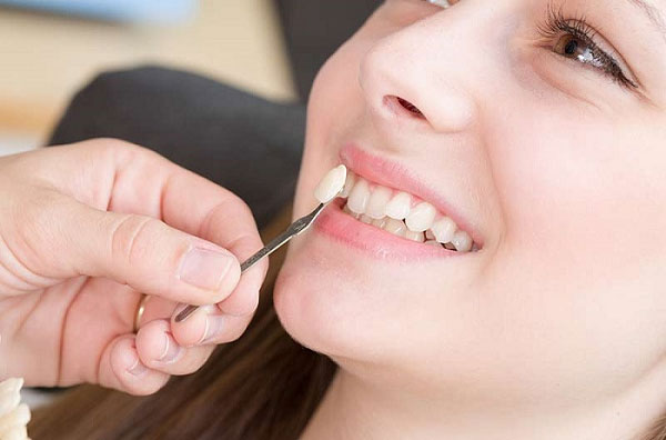 Tùy vào điều kiện và sở thích của mỗi người để chọn loại răng sứ phù hợp nhất