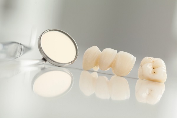 Chất liệu là yếu tố quan trọng quyết định tới chất lượng và giá cả của răng sứ