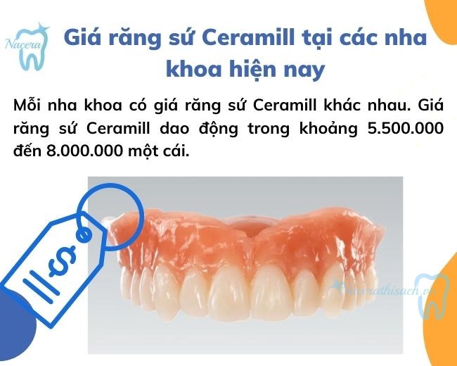 Giá răng sứ Ceramill tại các nha khoa hiện nay