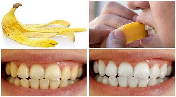 Cách lấy cao răng tại nhà bằng hoa quả với vỏ chuối