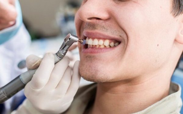 Lấy cao răng là cách đơn giản điều trị tụt lợi