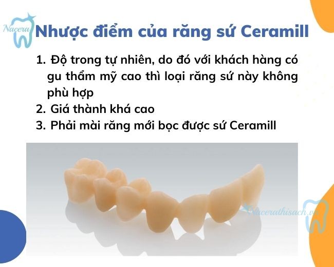 Nhược điểm của răng sứ Ceramill