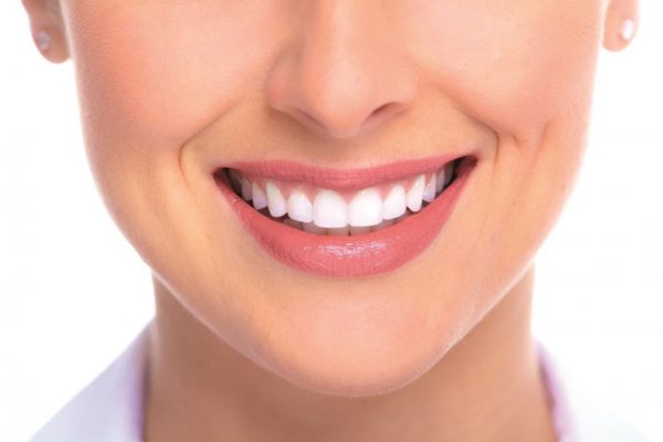 Bọc răng sứ giúp nụ cười tươi tắn, rạng rỡ hơn