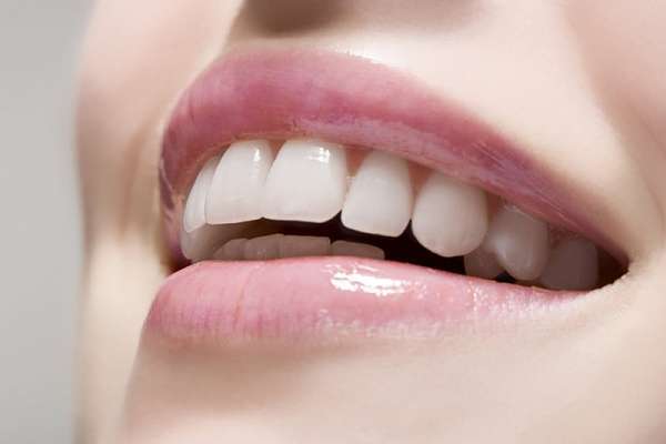 UT-Smile – Lựa chọn lý tưởng trong thẩm mỹ răng sứ
