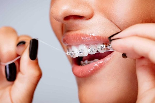 Việc chăm sóc răng miệng và tái khám định kì đặc biệt quan trọng