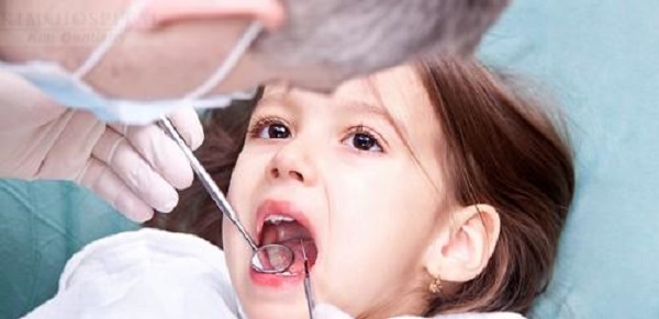 Trước khi dùng dụng cụ niềng răng tại nhà, bệnh nhân nên tham khảo ý kiến của bác sĩ