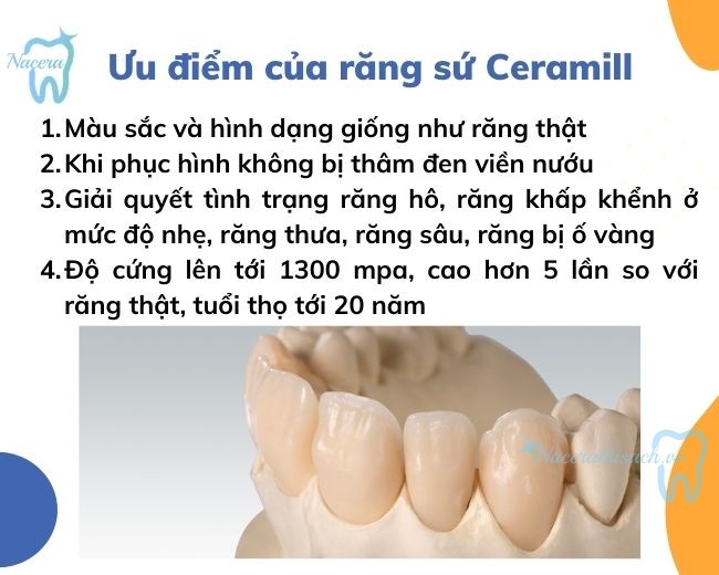 Tại sao nên chọn răng sứ Ceramill? Răng sứ Ceramill có những ưu điểm nào?
