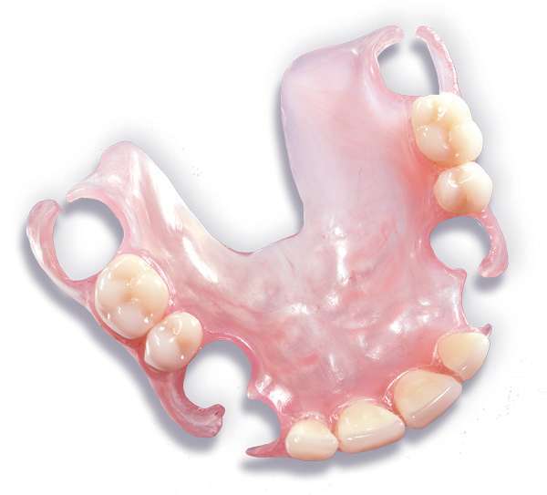 Răng giả tháo lắp nhựa dẻo là phương pháp phục hồi răng đã mất phổ biến