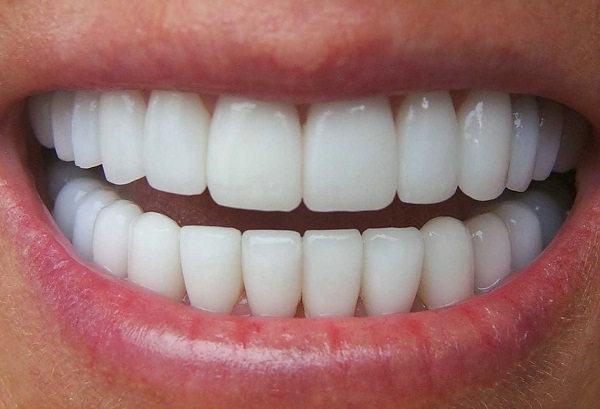 Bọc răng sứ giá rẻ được nhiều người sử dụng mà không biết hậu quả của nó