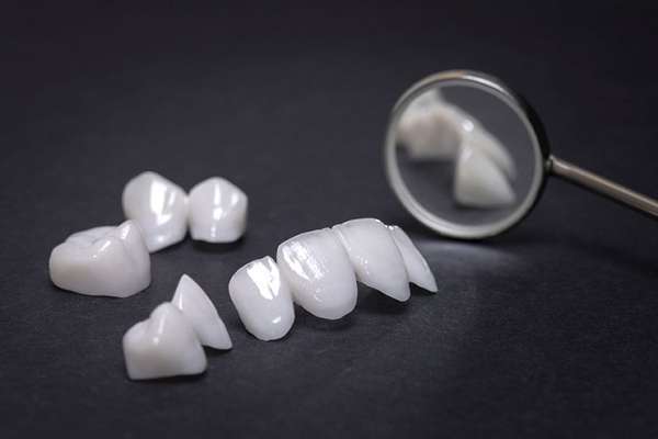 Mặt dán sứ Veneer đem lại hàm răng trắng sáng và đều đẹp tự nhiên