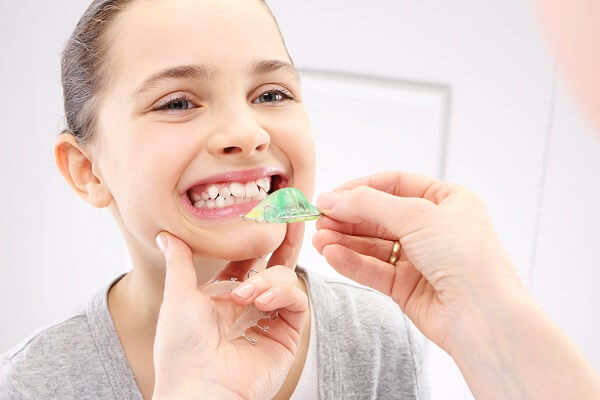 Phương pháp niềng răng tháo lắp thuận tiện cho việc ăn uống và vệ sinh răng miệng