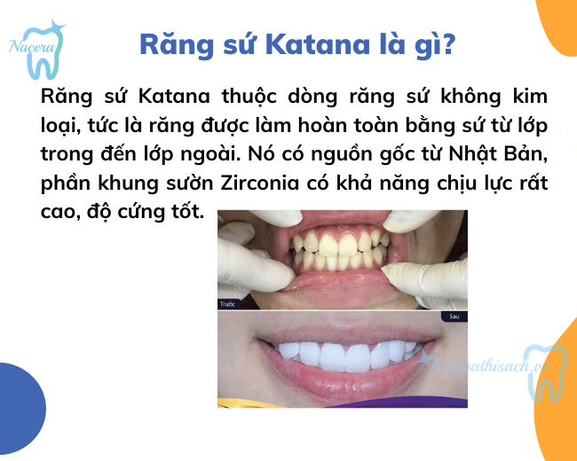 Răng sứ Katana là gì?