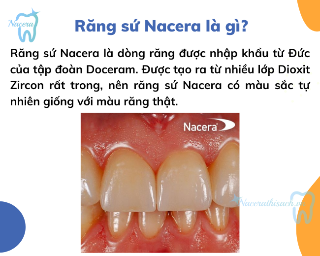 Răng toàn sứ Nacera là gì?