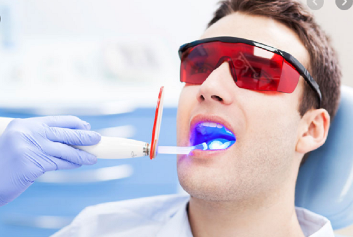 Thoa thuốc và chiếu đèn laser để tẩy trắng răng