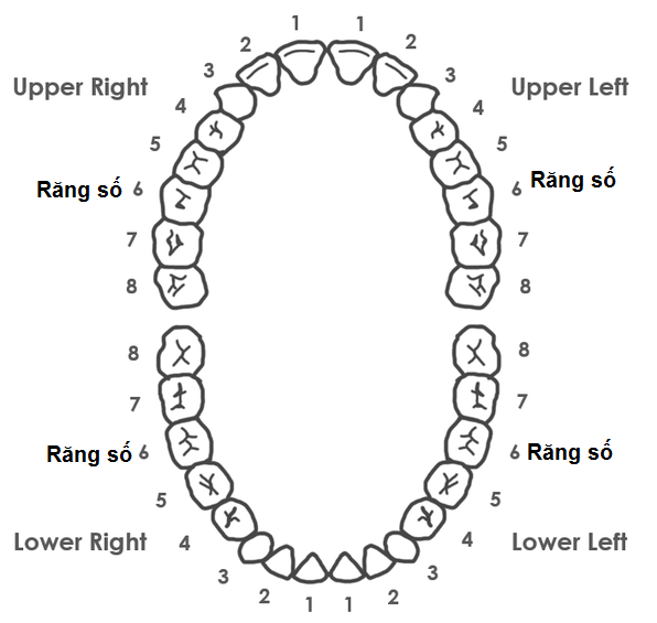 Vị trí răng số 6 hàm trên và hàm dưới