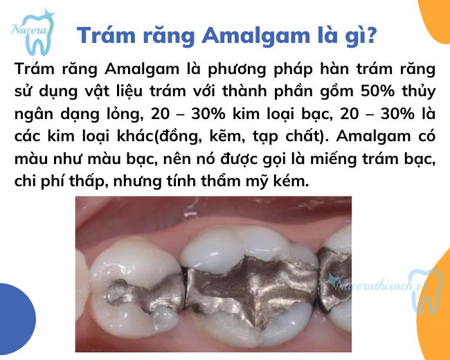 Trám răng Amalgam là gì?