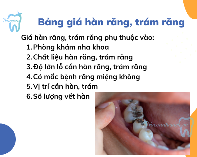 Giá hàn răng, trám răng phụ thuộc vào những yếu tố nào