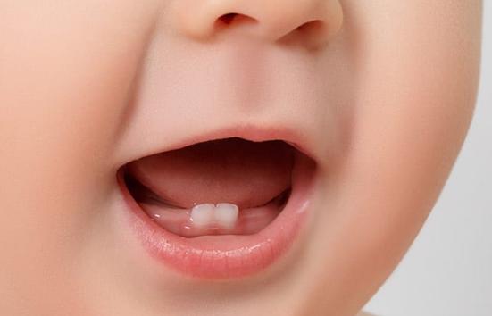 Chiếc răng sữa đầu tiên nhú khỏi lợi của bé khi bé được 4 - 6 tháng tuổi