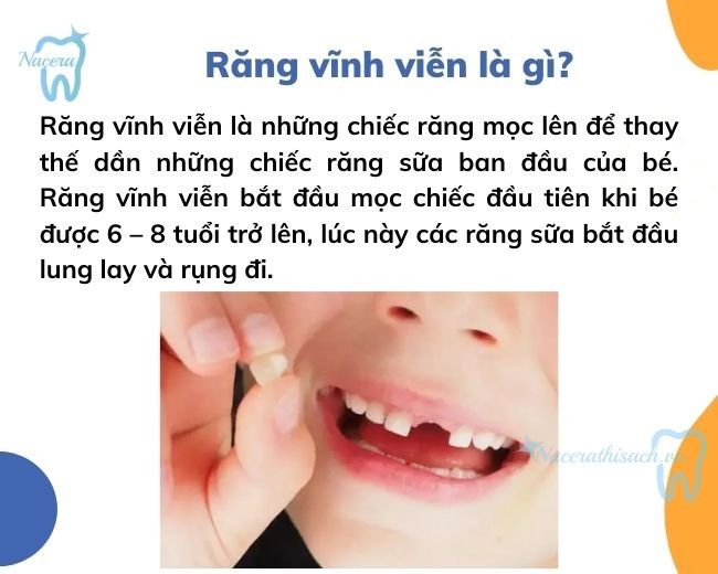 Răng vĩnh viễn là gì?