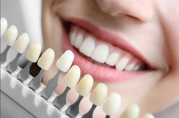 Bọc răng sứ nên chọn phòng khám nha khoa uy tín