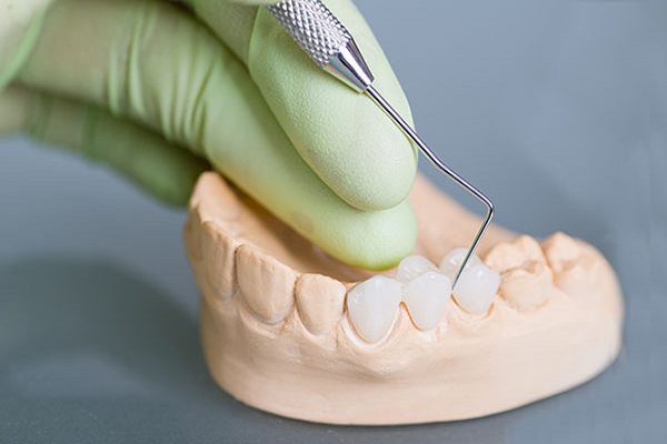 Công nghệ hiện đại tạo nên những dòng răng sứ đạt độ chuẩn xác, tính thẩm mỹ và chất lượng