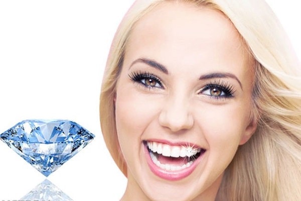 Đính đá kim cương cho răng – Phương pháp thẩm mỹ nha khoa sành điệu