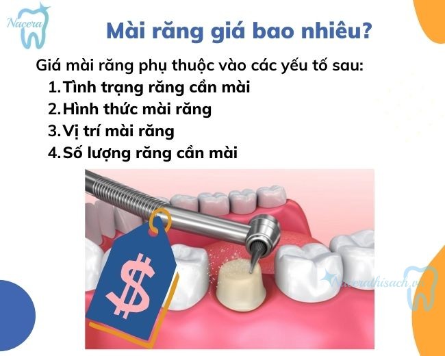 Mài răng giá bao nhiêu? Giá mài răng tại các nha khoa