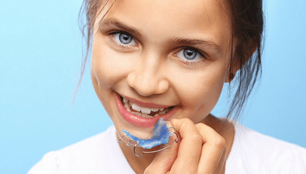 Niềng răng ốc nông rộng phù hợp cho trẻ em từ 6 – 16 tuổi