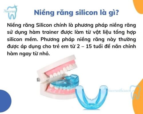 Niềng răng Silicon là gì?