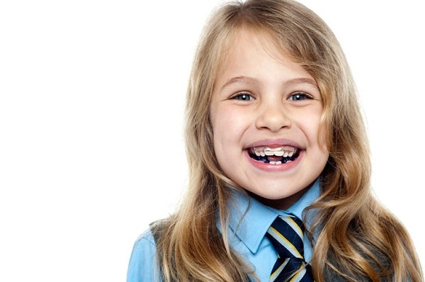 Khi nào nên niềng răng cho trẻ?