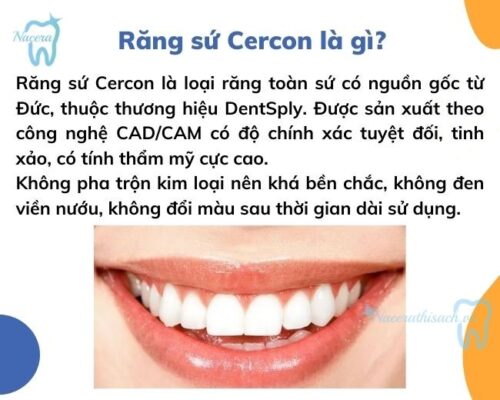 Răng sứ Cercon là gì?
