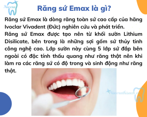 Răng sứ Emax là gì? Cấu tạo như thế nào?