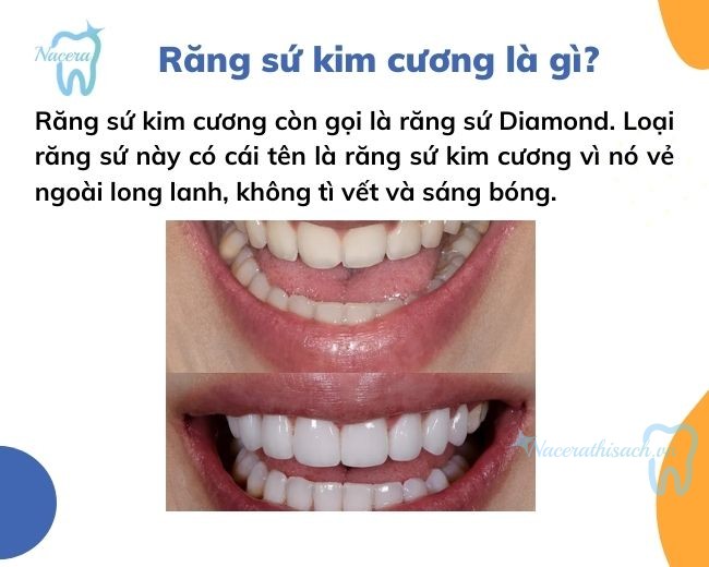 Răng sứ Diamond có ưu điểm gì so với các loại răng sứ khác?
