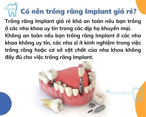 Trồng răng Implant giá rẻ có đảm bảo an toàn và chất lượng không?